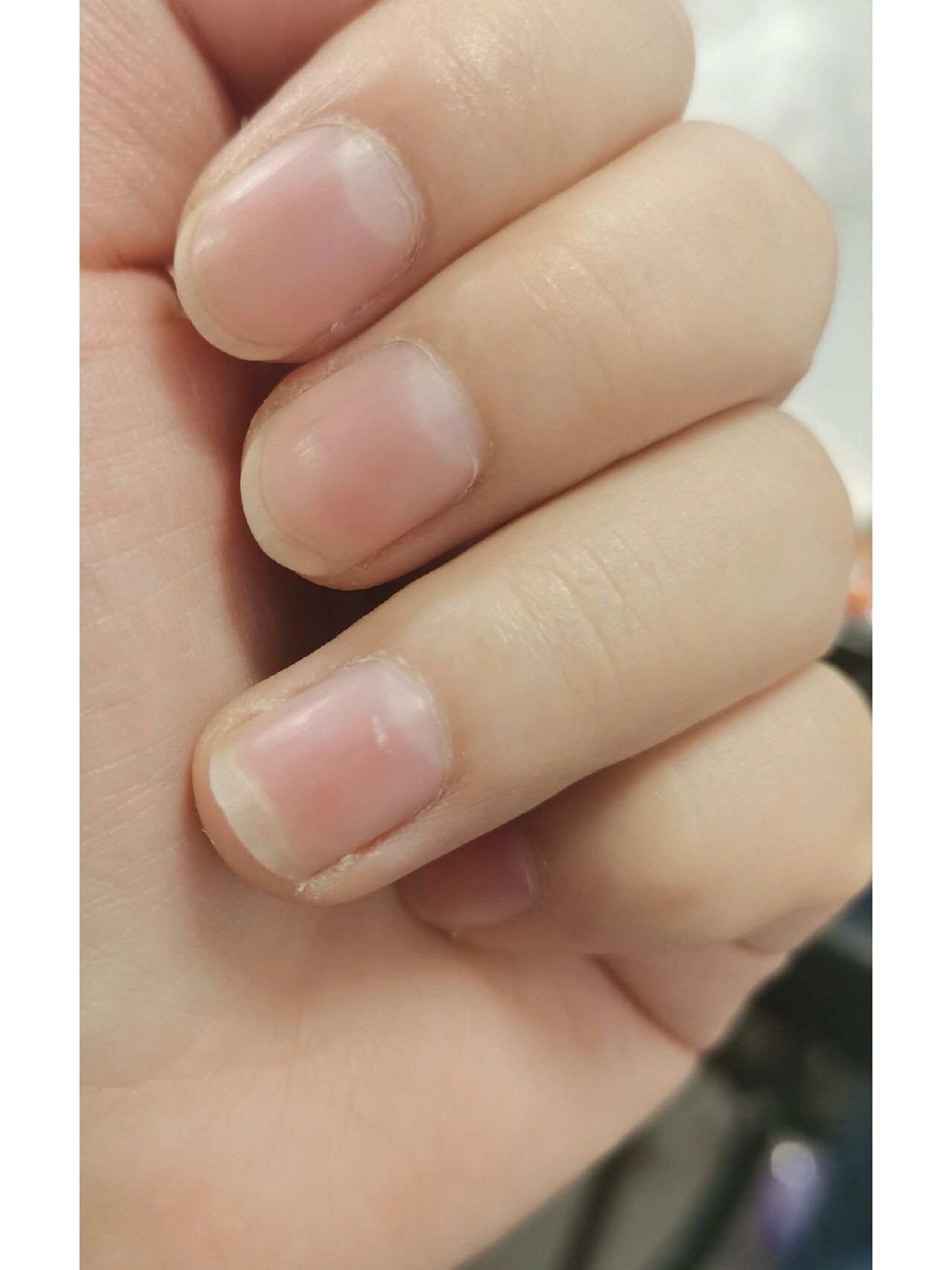 手指甲上有白点是怎么回事