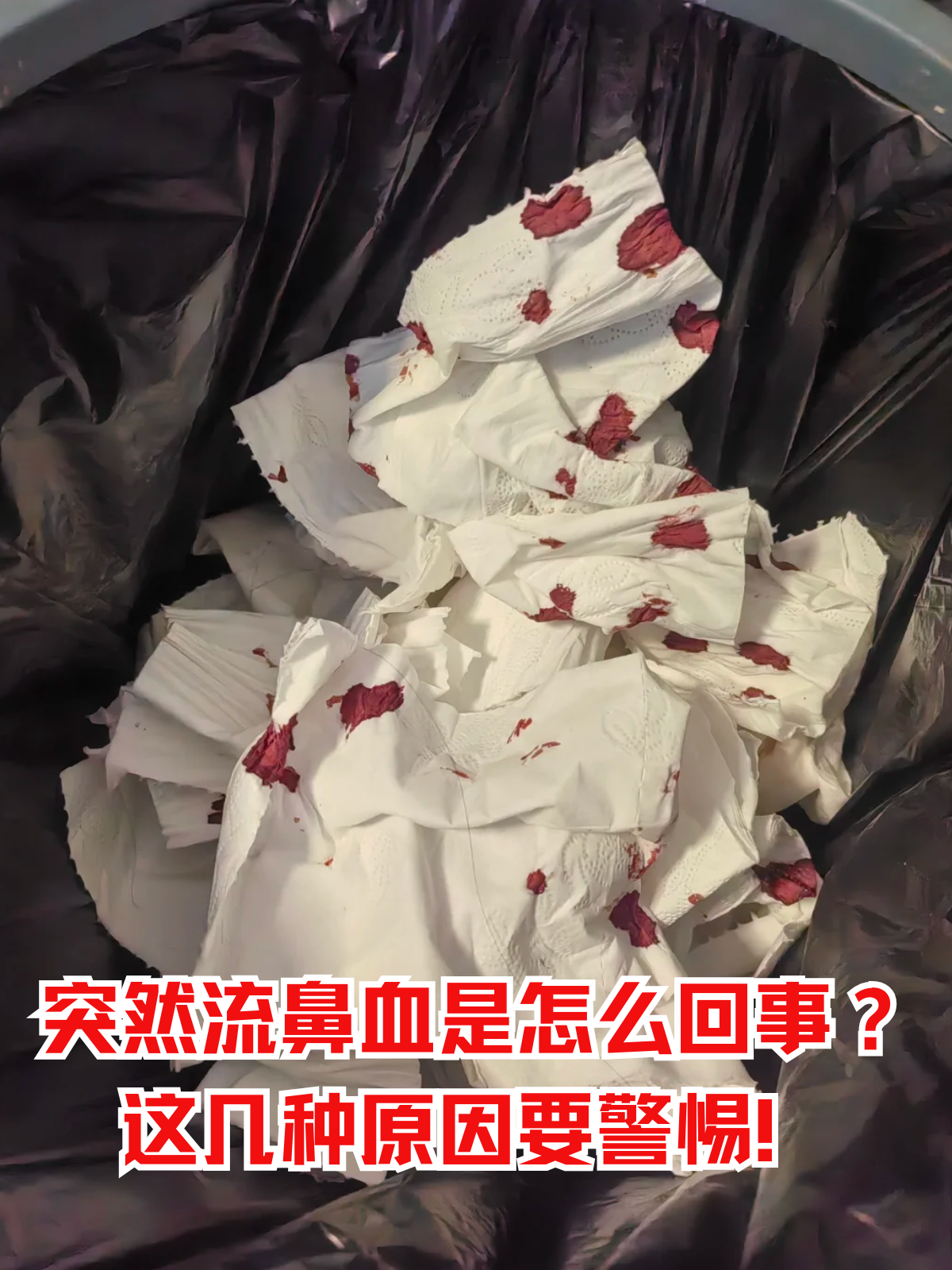 小孩子突然流鼻血是怎么回事