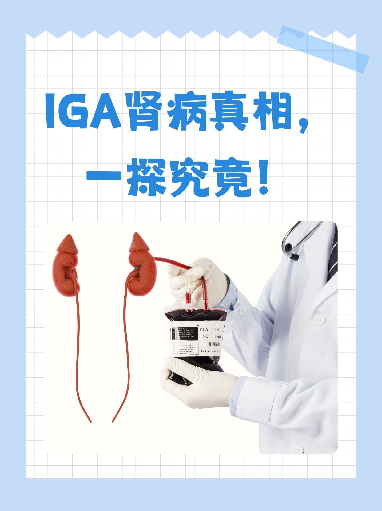 iga肾病算肾炎吗