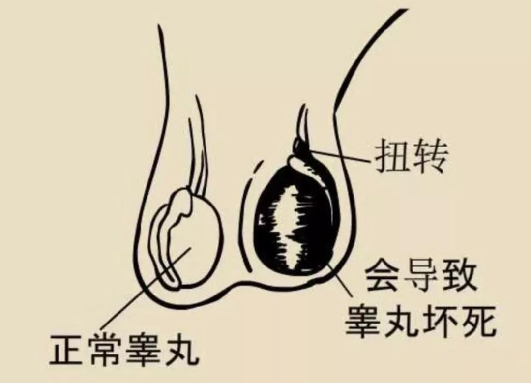睾丸长什么样子