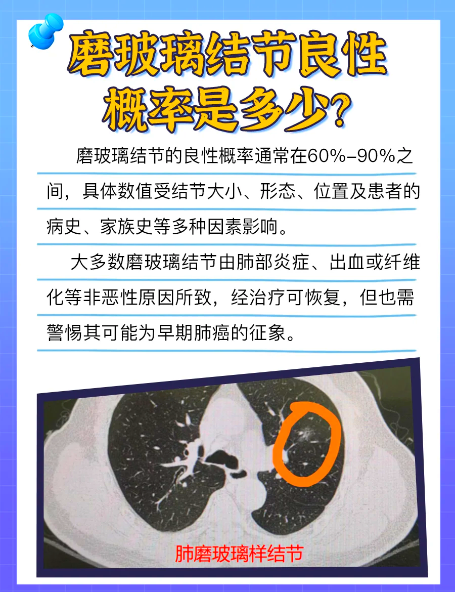 肺部磨玻璃结节会消失吗