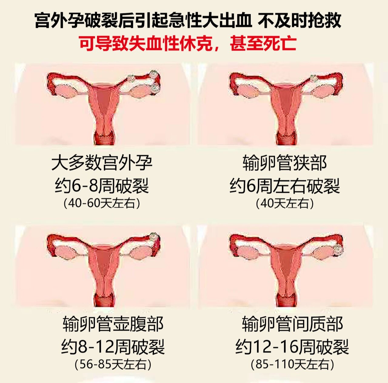 宫外孕发生的原因有哪些