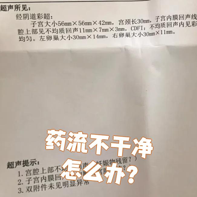 药流不清宫可以吗