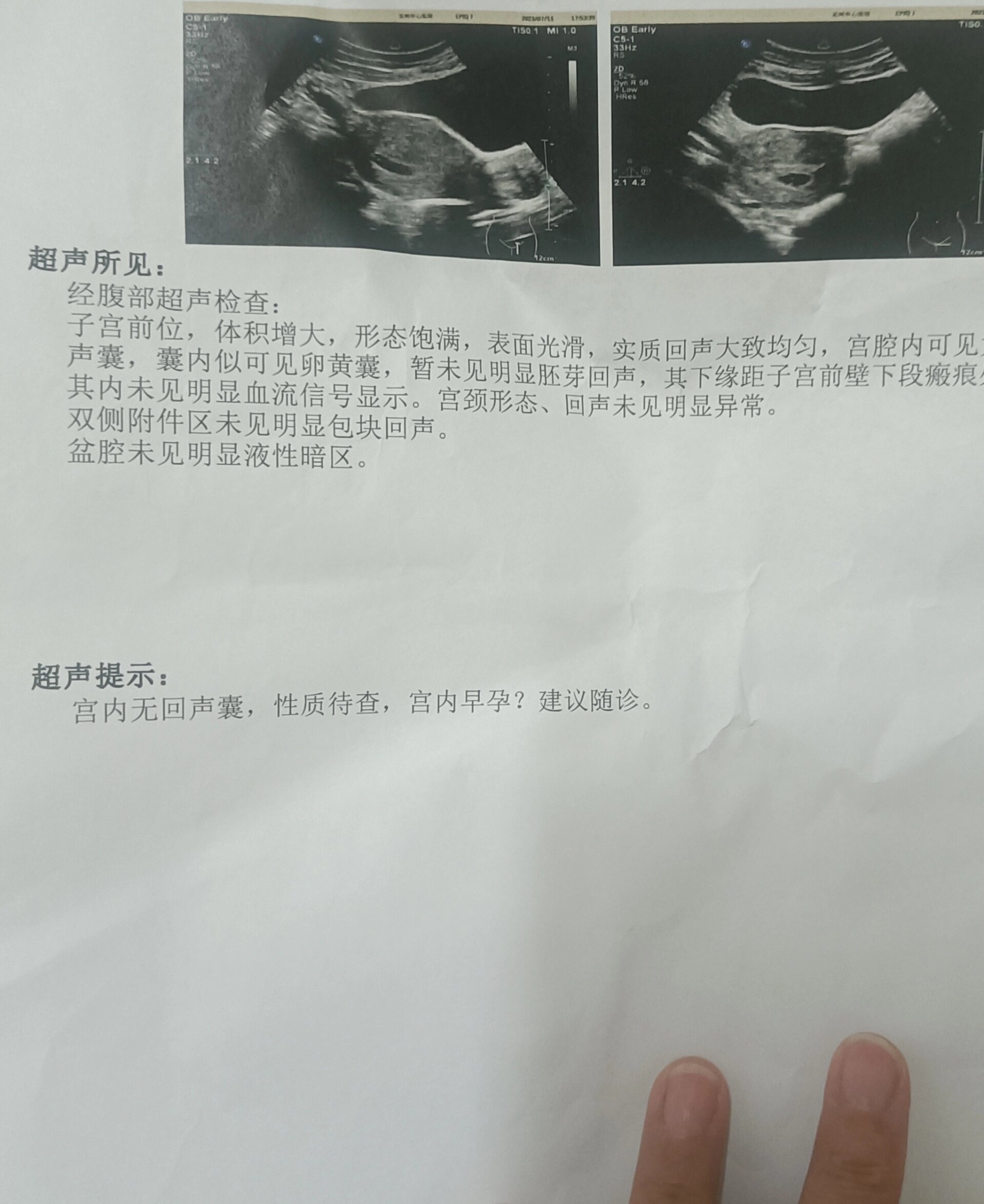 庞智美 第3页