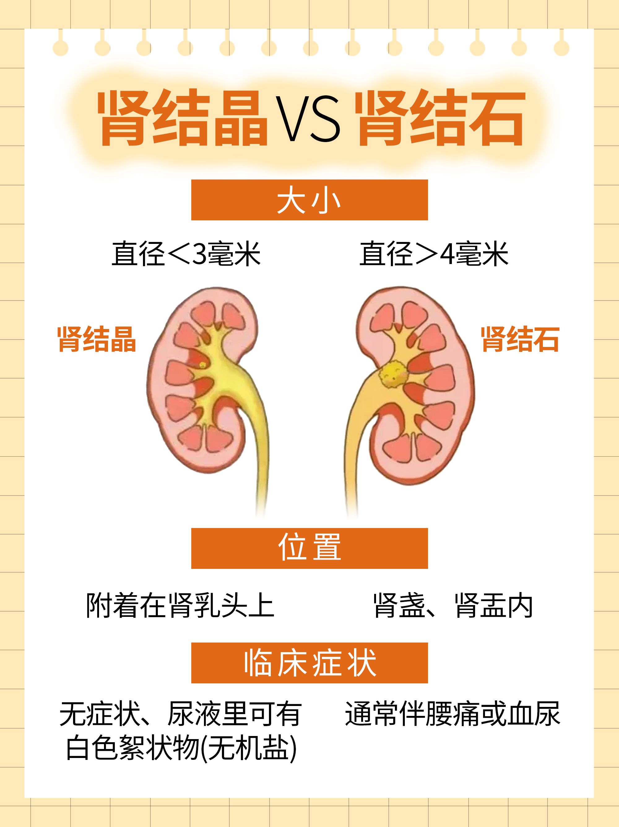 肾结石怎么形成的