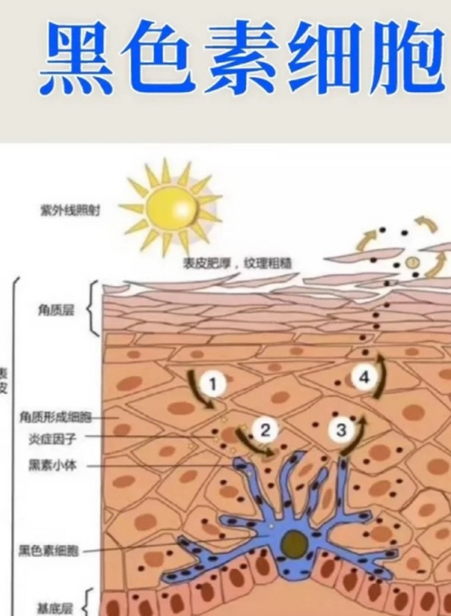 无色素痣是怎么回事