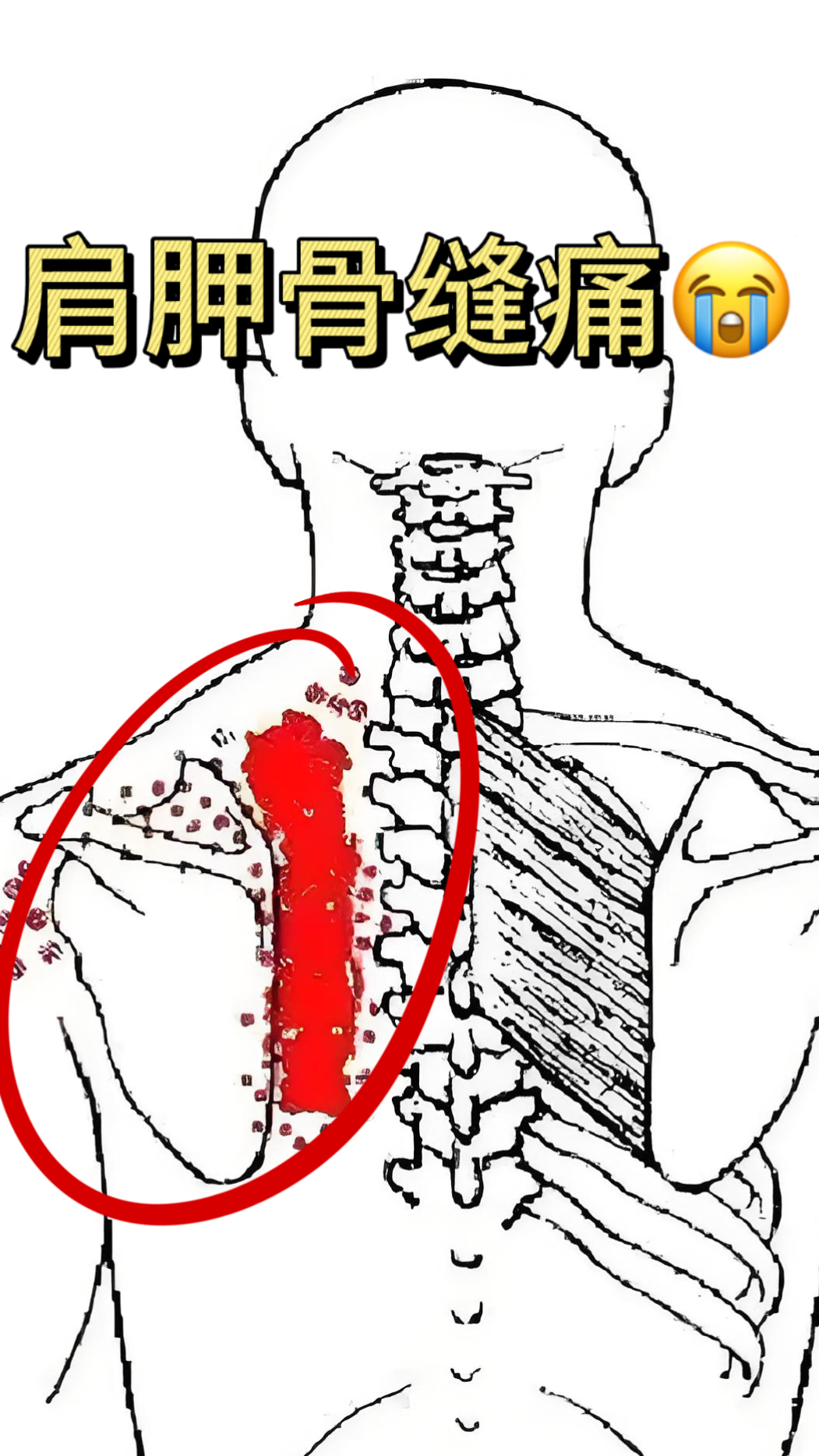 肩胛骨缝疼是怎么回事