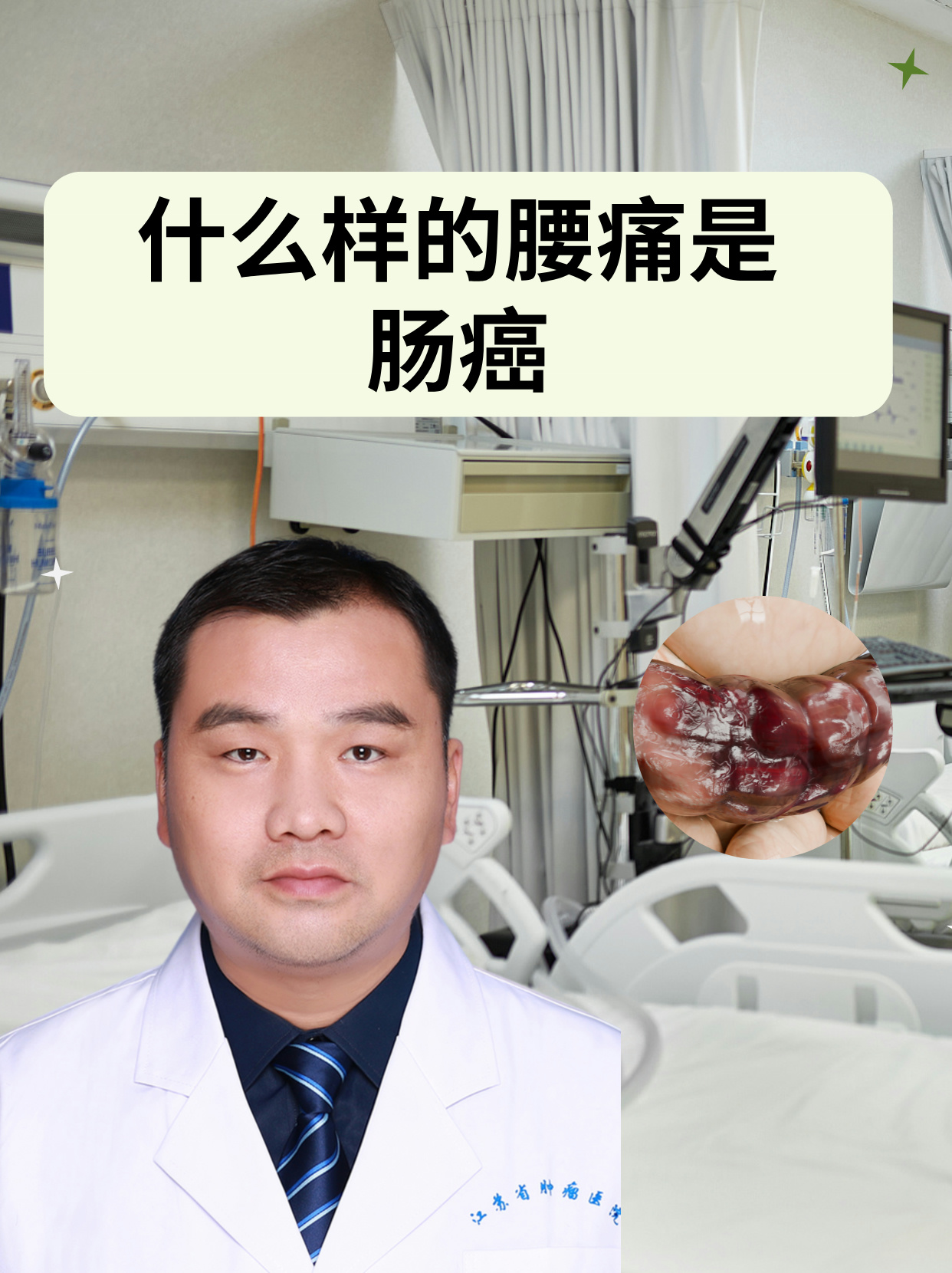 肠癌早期会腹疼吗