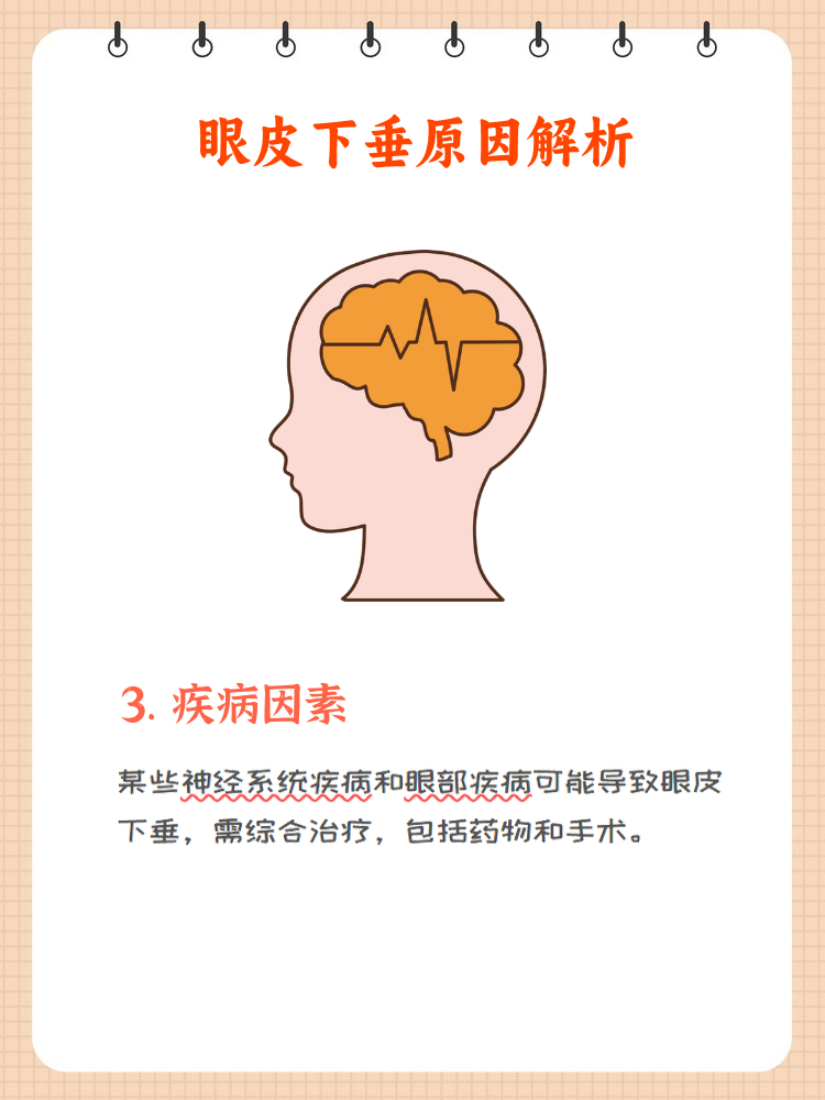 上眼睑下垂是什么原因?