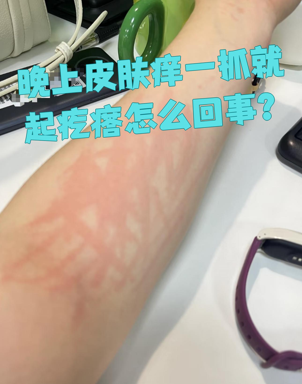 身上痒起疙瘩是怎么回事