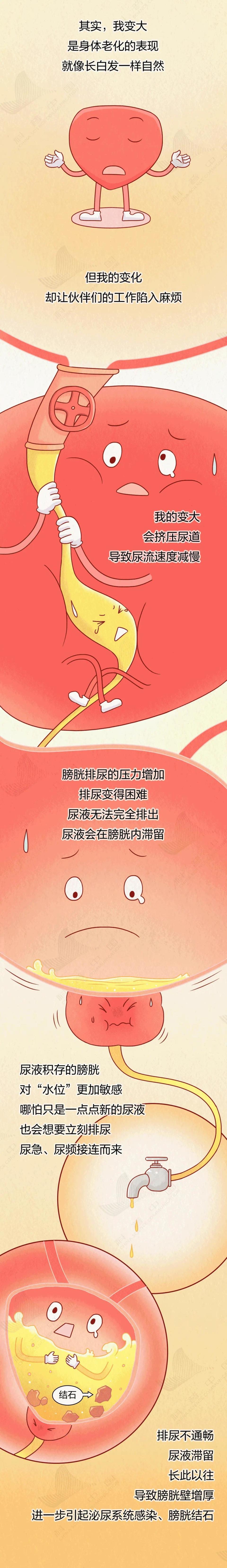 前列腺癌晚期能活多久?
