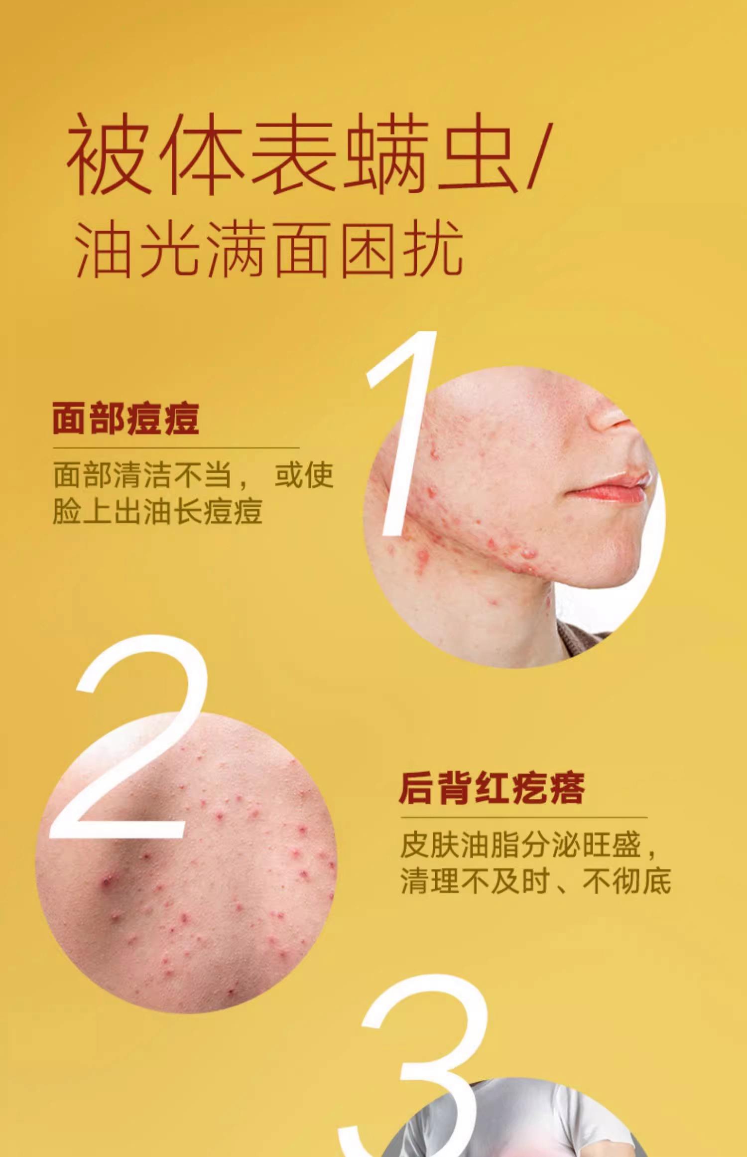 硫磺皂主要有什么用?对皮肤有过敏吗?