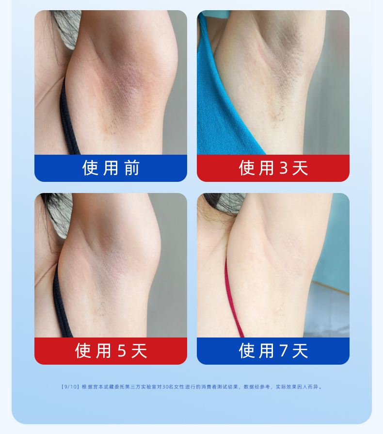 腋下除臭手术