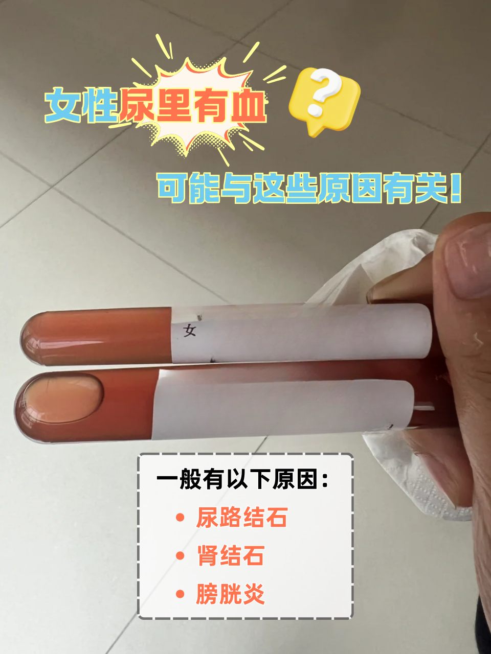 小便带血是什么原因