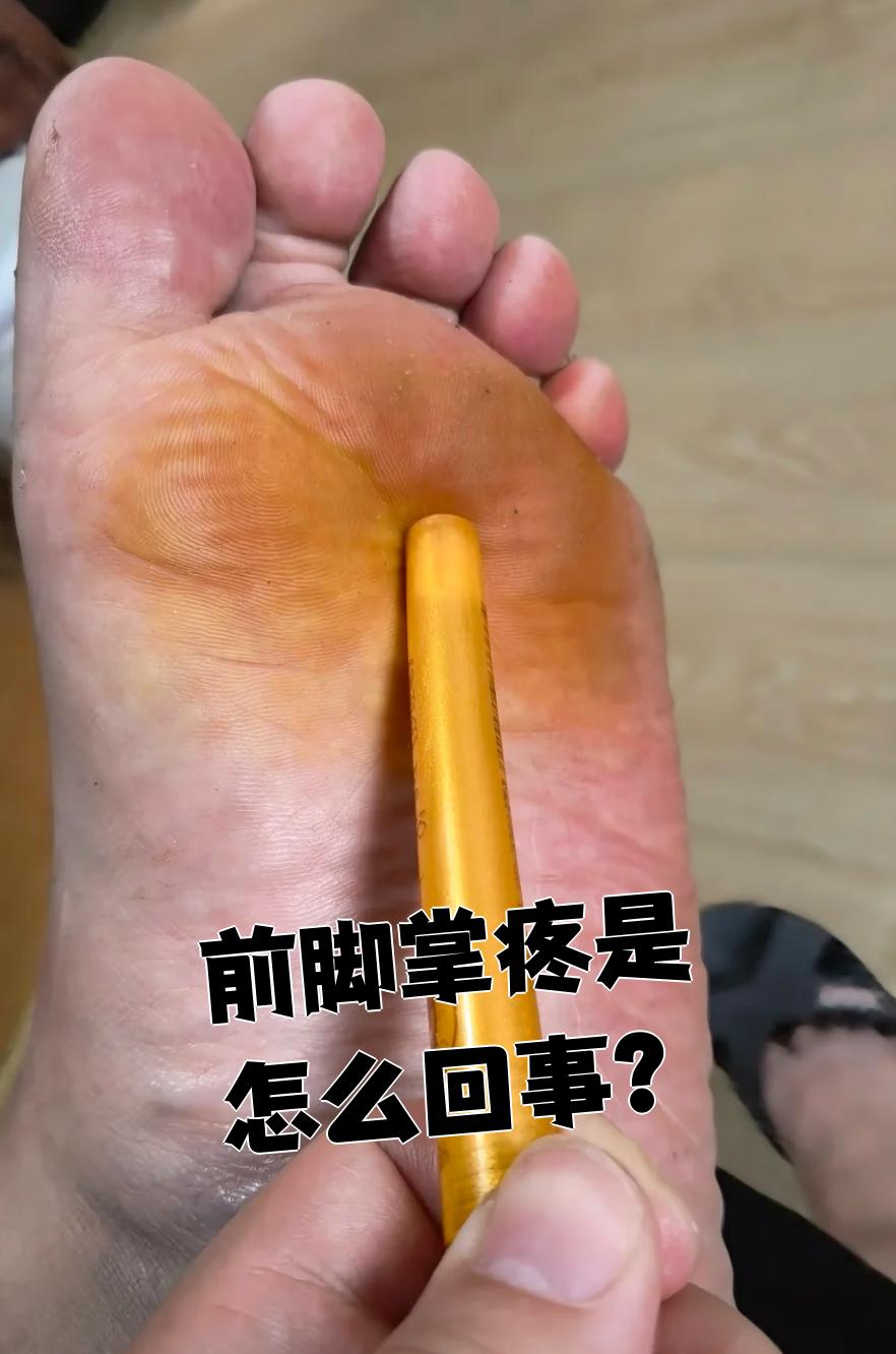 脚底板痛是怎么回事?