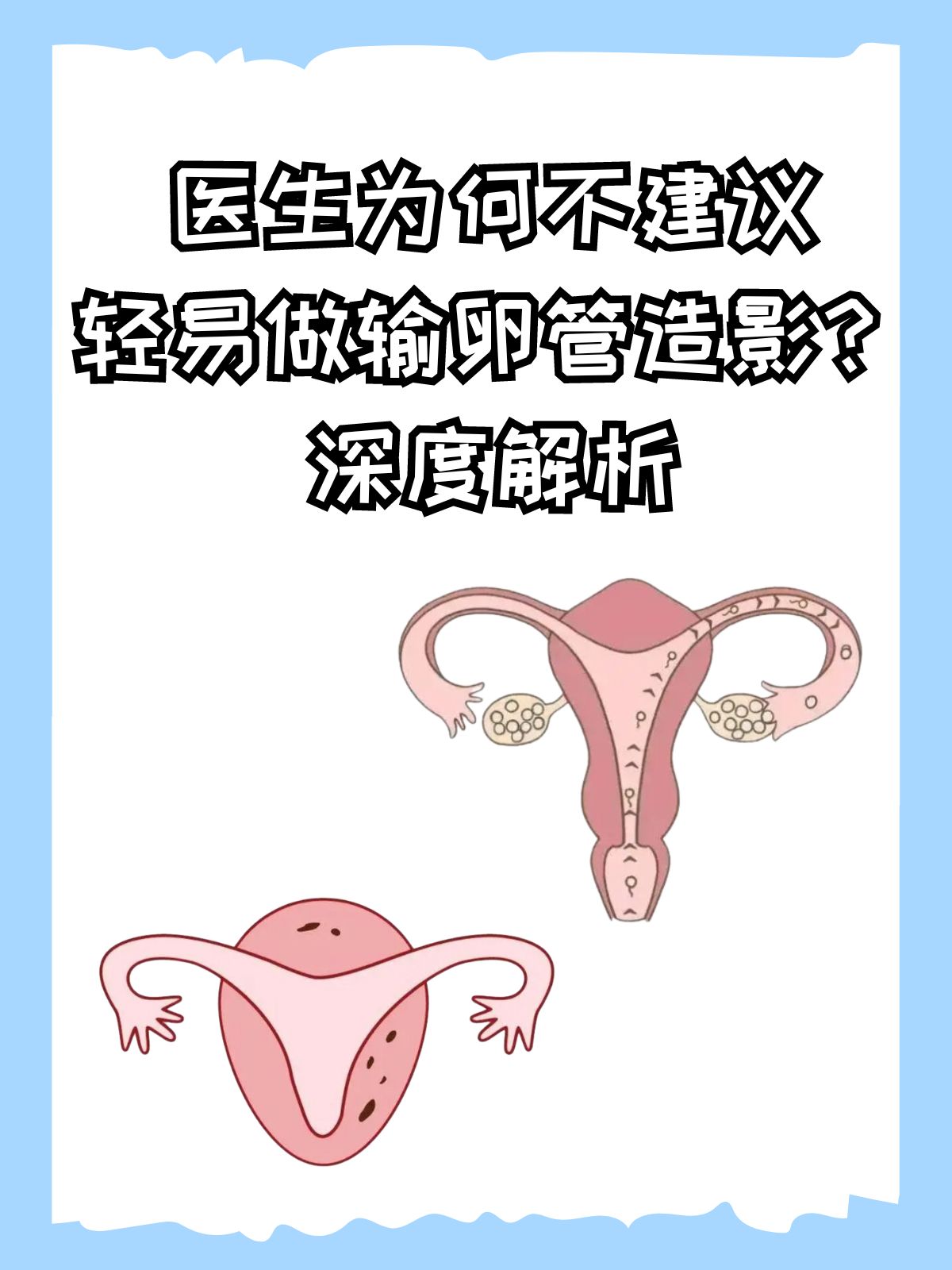 输卵管检查都有哪些?