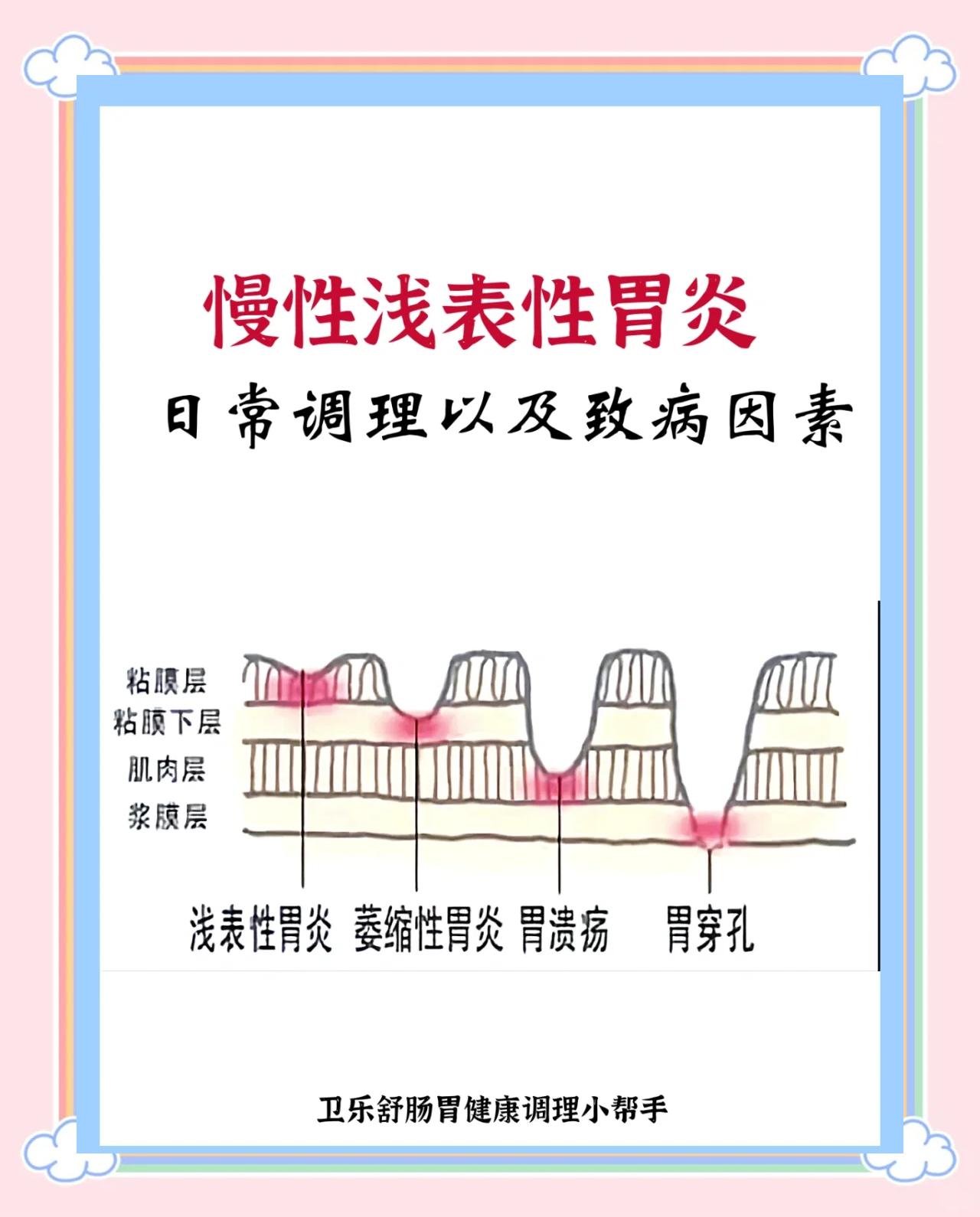浅表性胃炎怎样根治