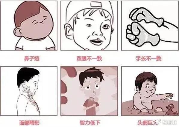 18三体综合征是什么意思