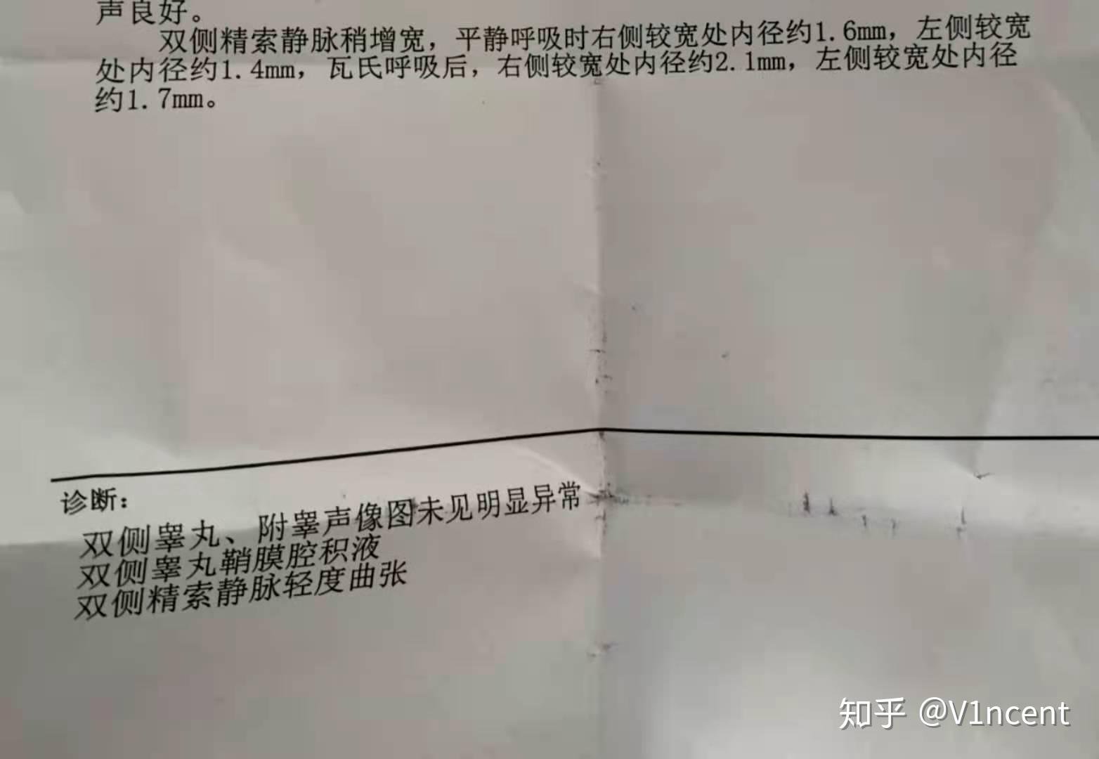 精索静脉曲张手术后多久恢复原样