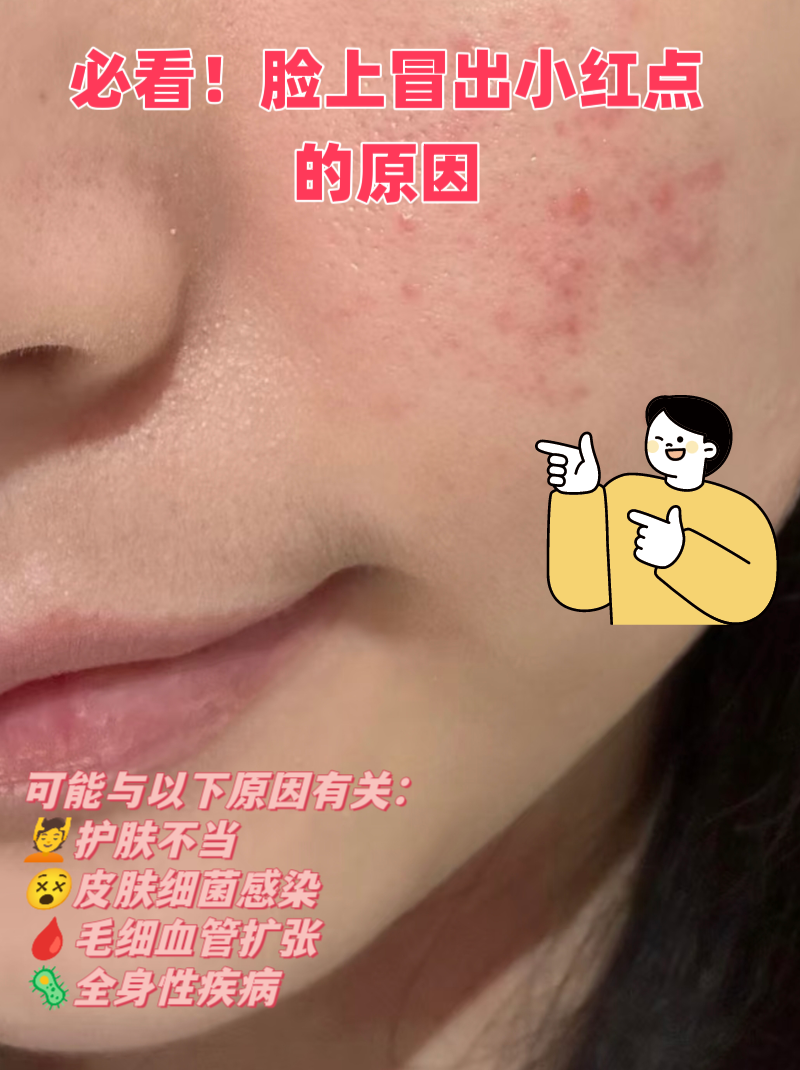 脸上长红点不痒,不痛,怎么办