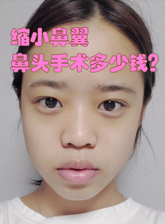 鼻孔可以缩小吗?