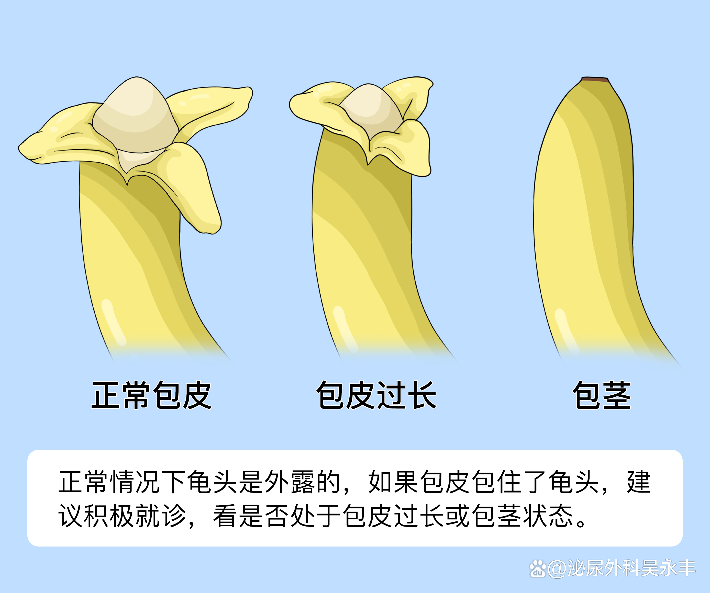 什么是包皮?包皮图片是什么样的?