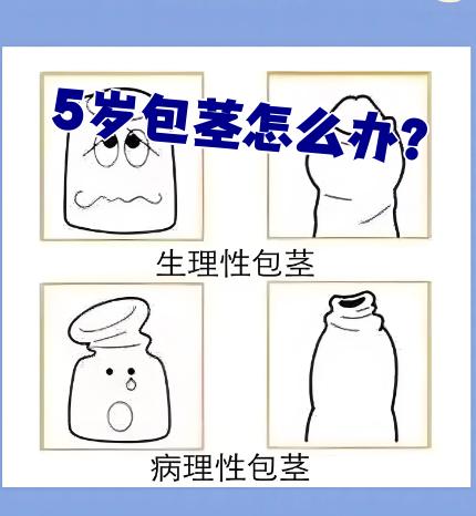 什么是包皮?包皮图片是什么样的?