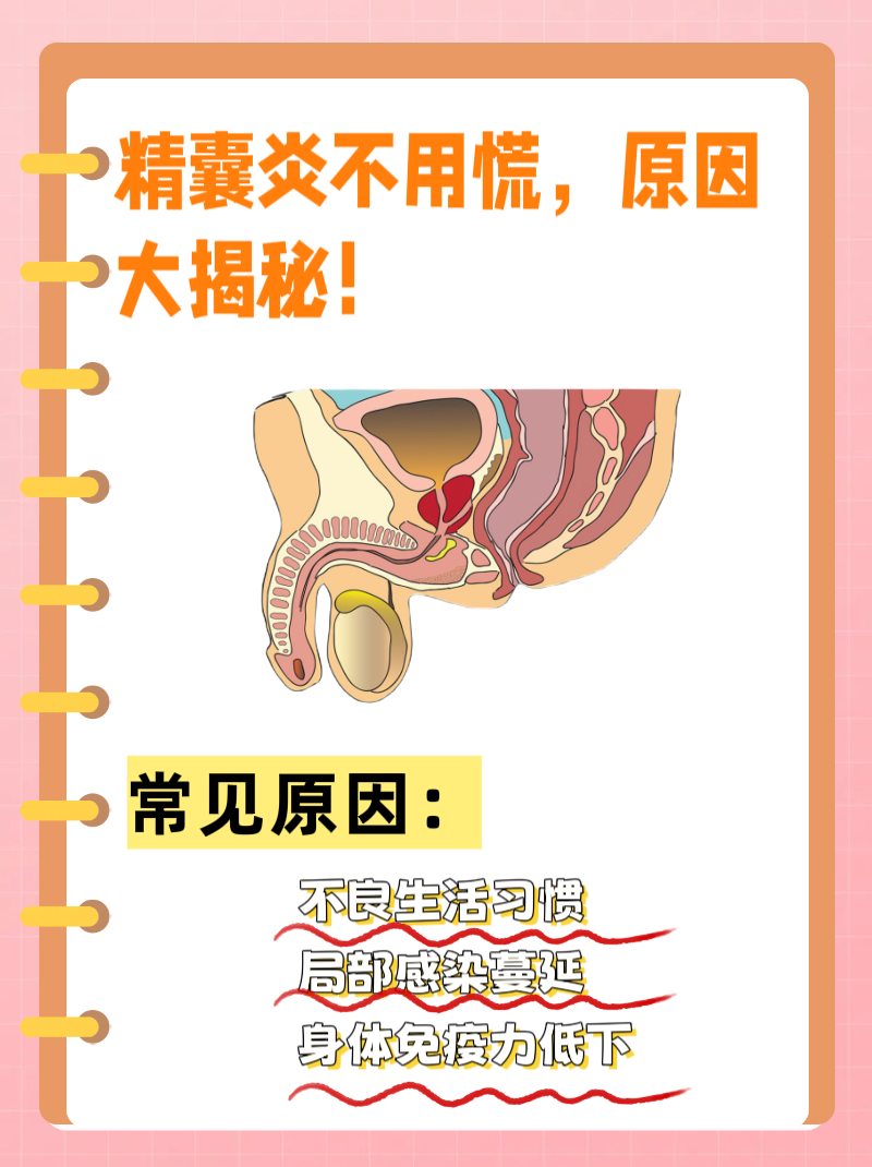 精囊炎图片