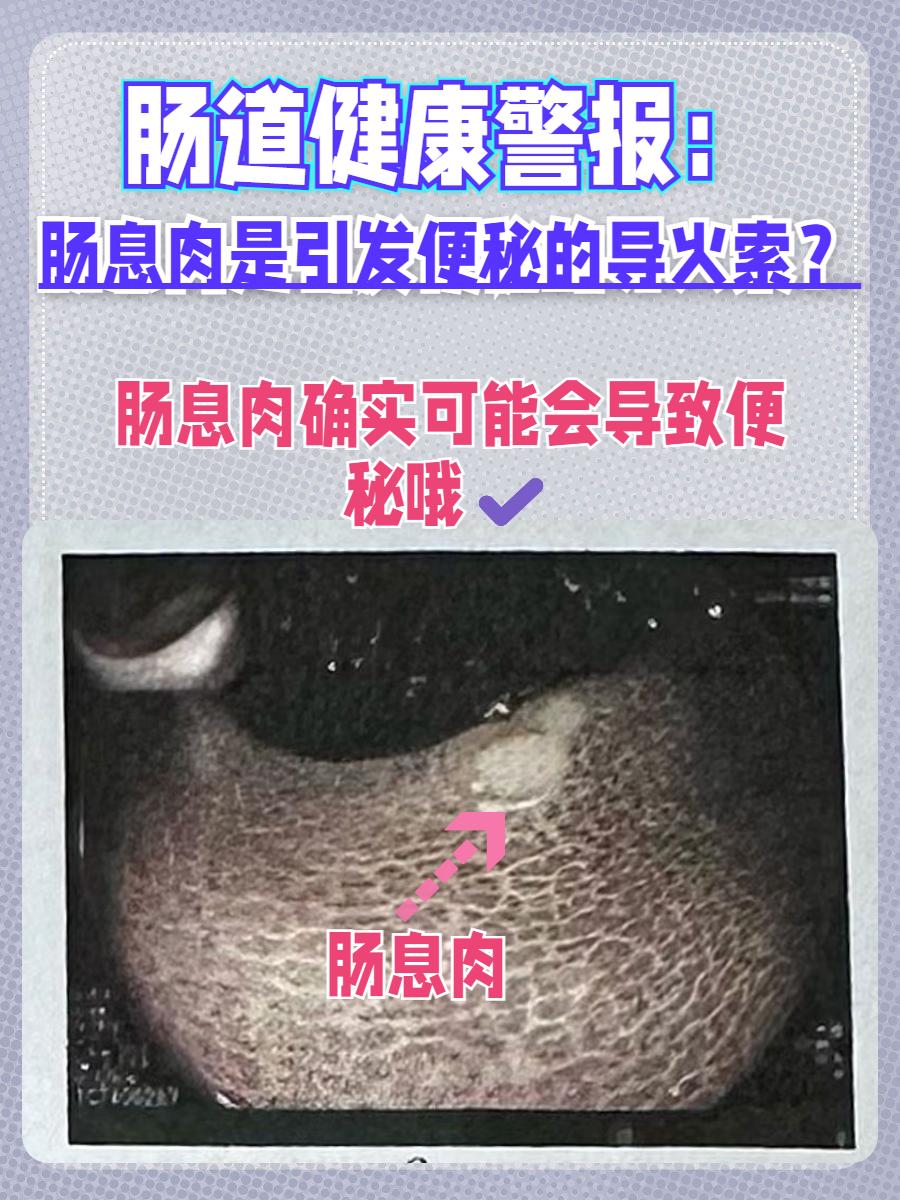 直肠息肉的早期症状是什么