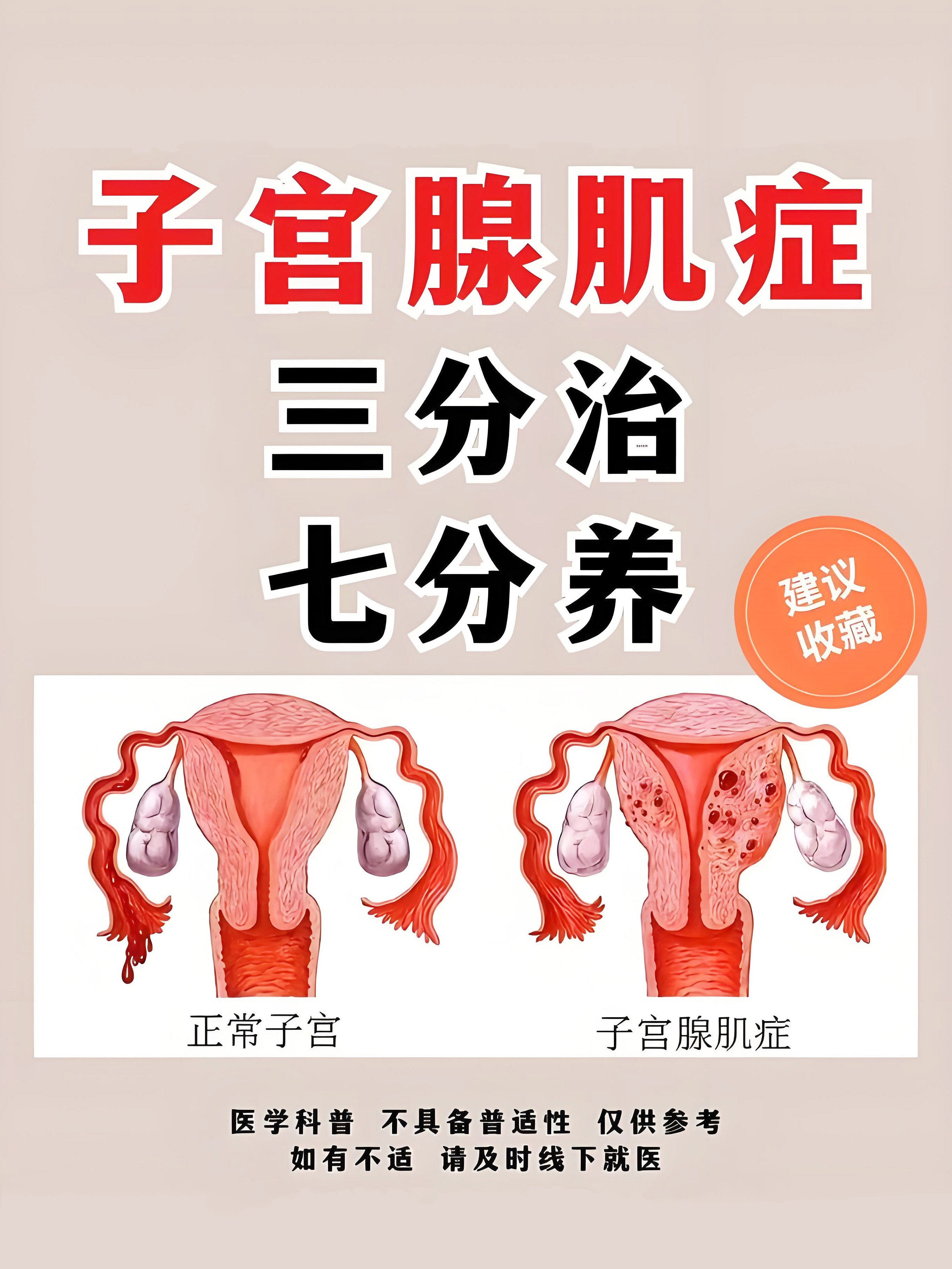 请问子宫肌腺瘤是什么意思?