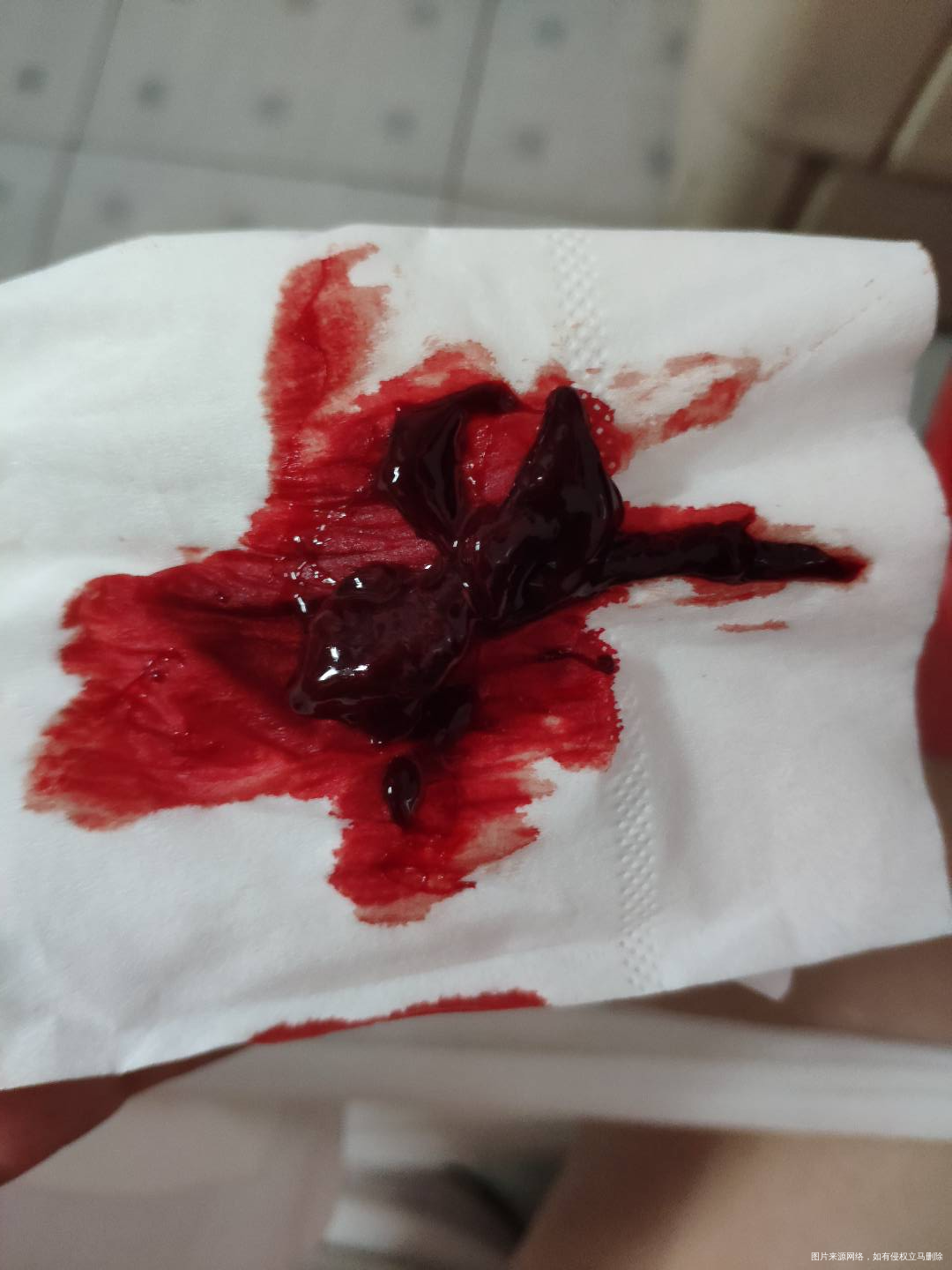 恶露已经排干净了又有鲜血