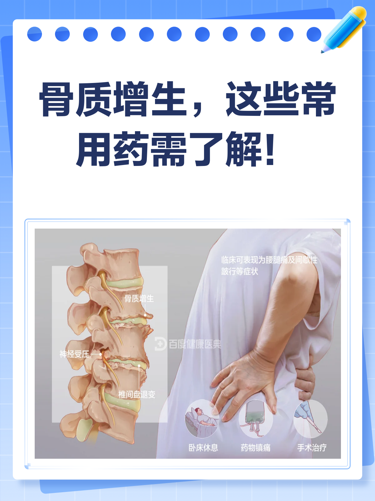 骨质增生偏方