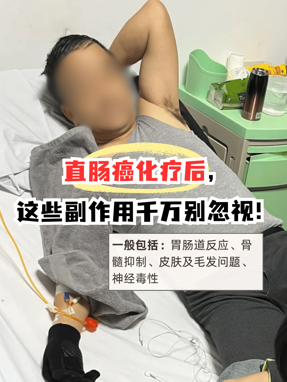 肠癌术后能活多久