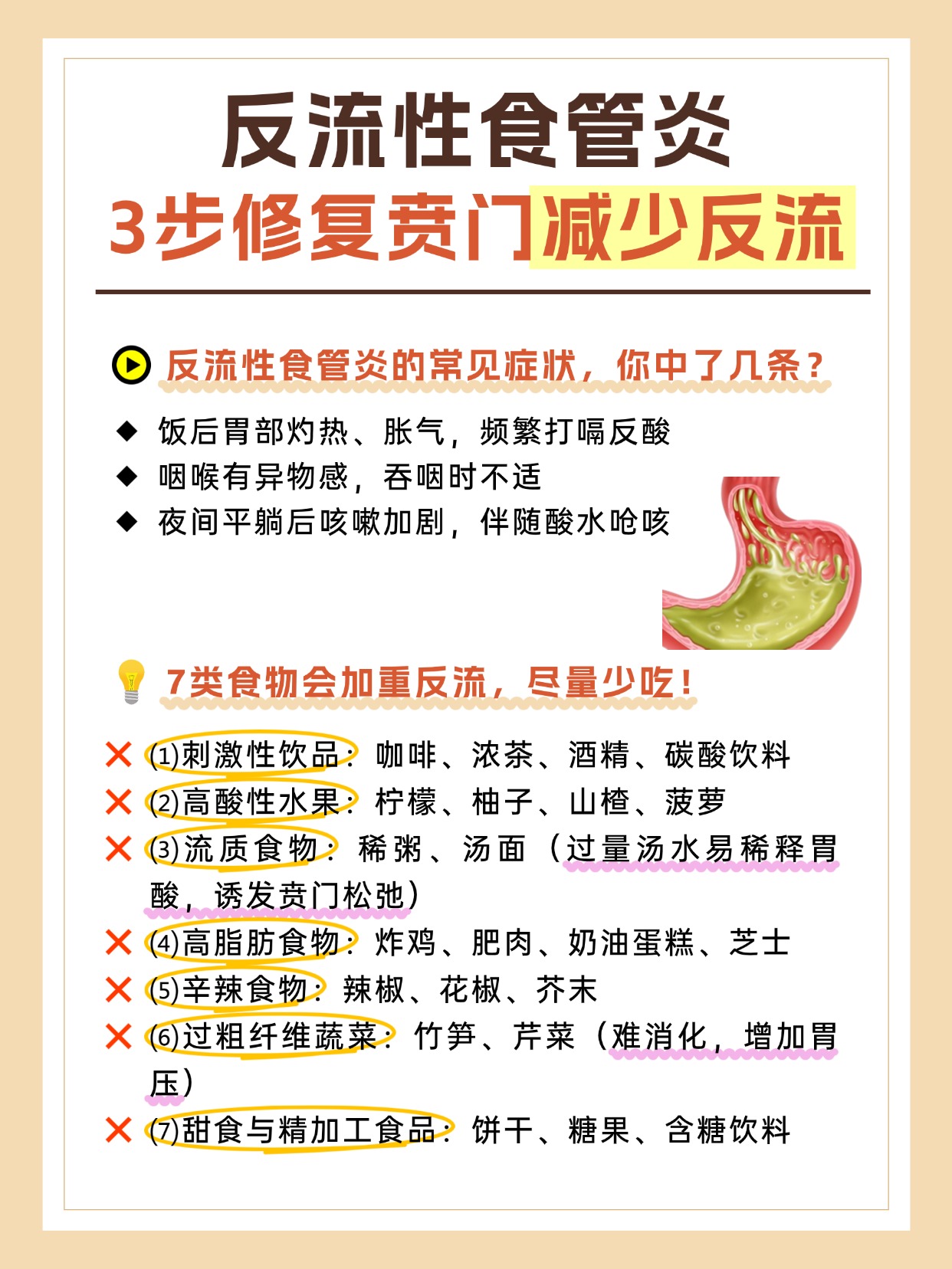 治疗反流性食管炎的最佳方法