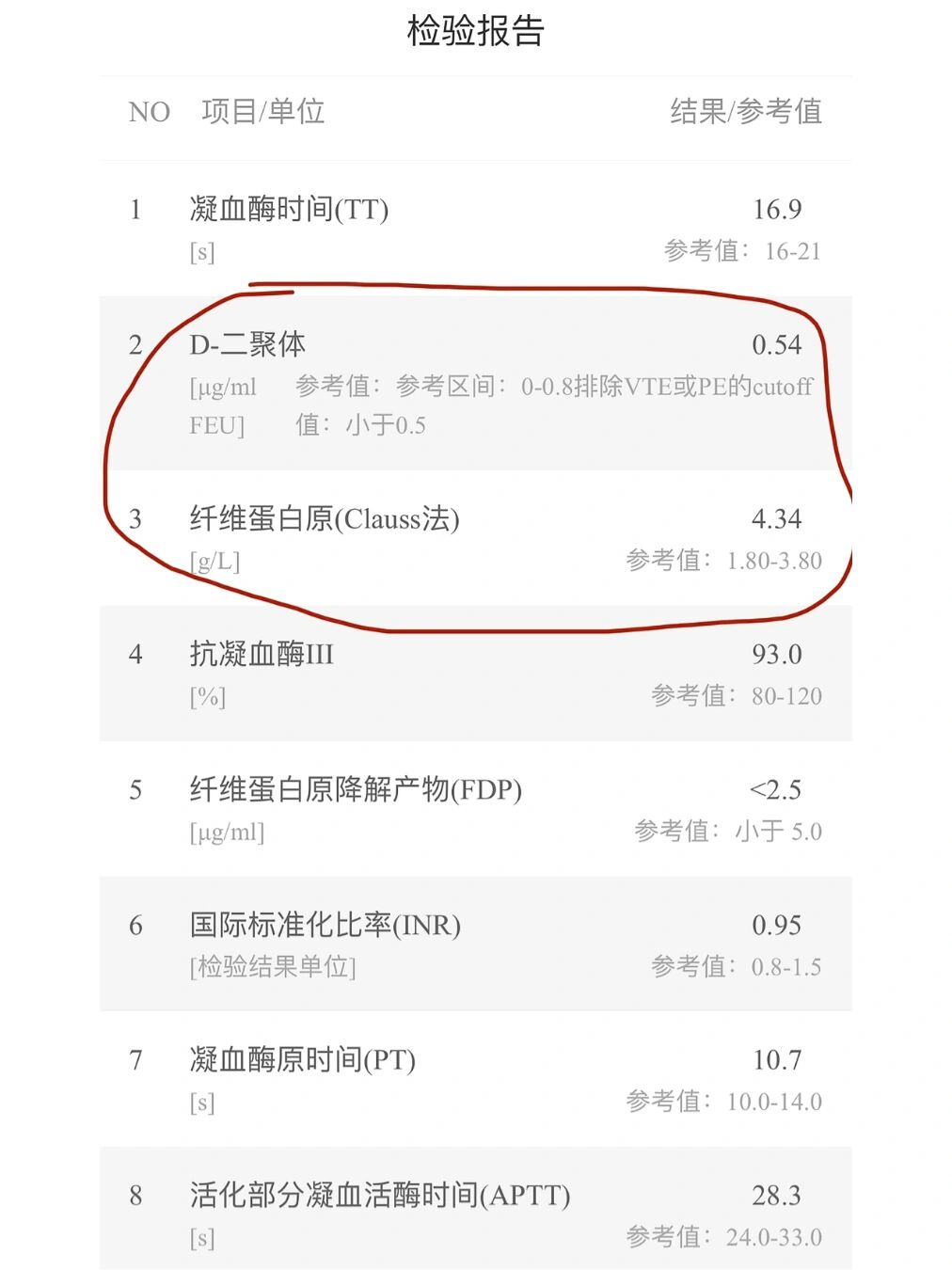 D-二聚体高说明什么?