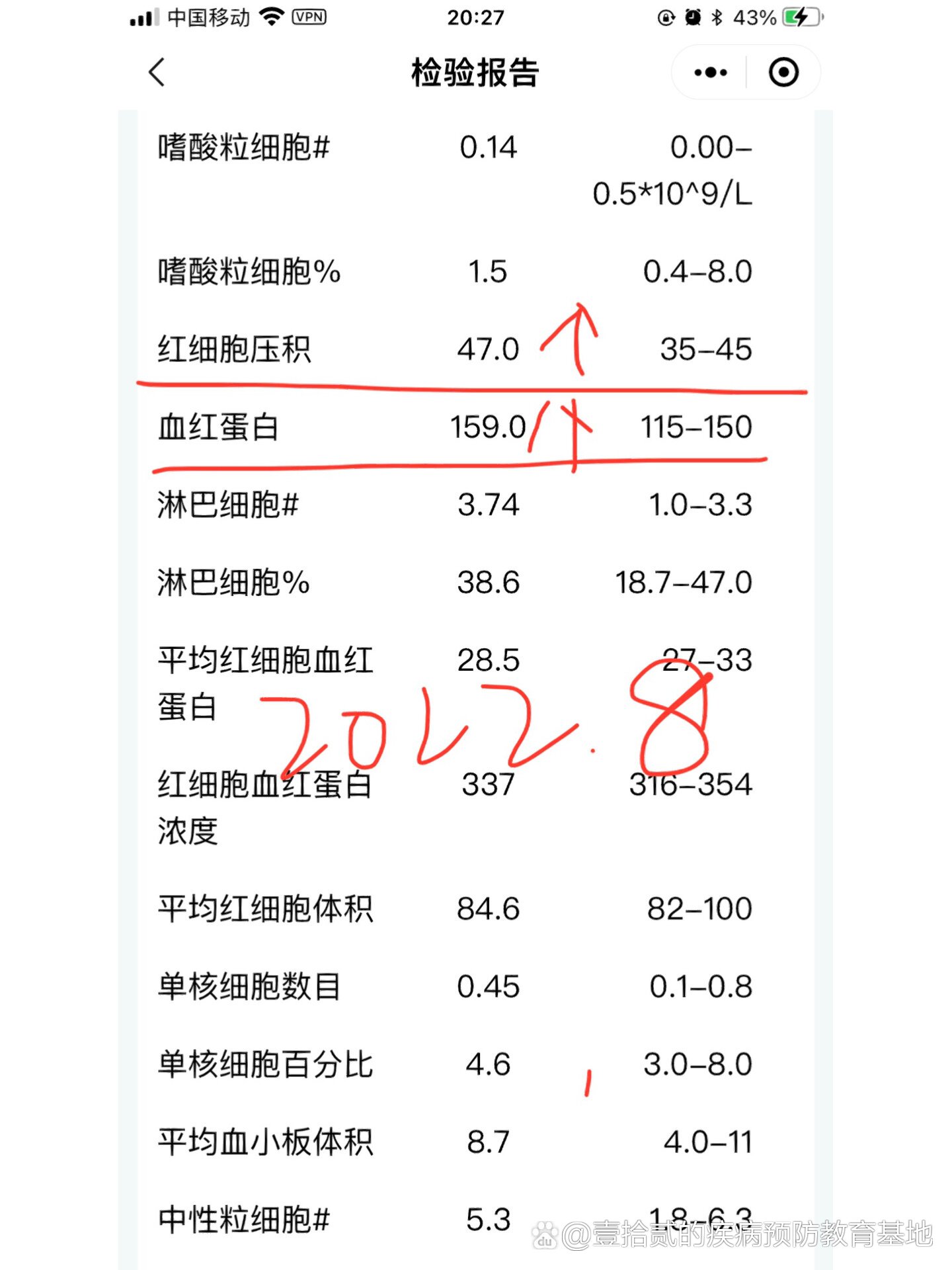 红细胞压积偏高会怎样