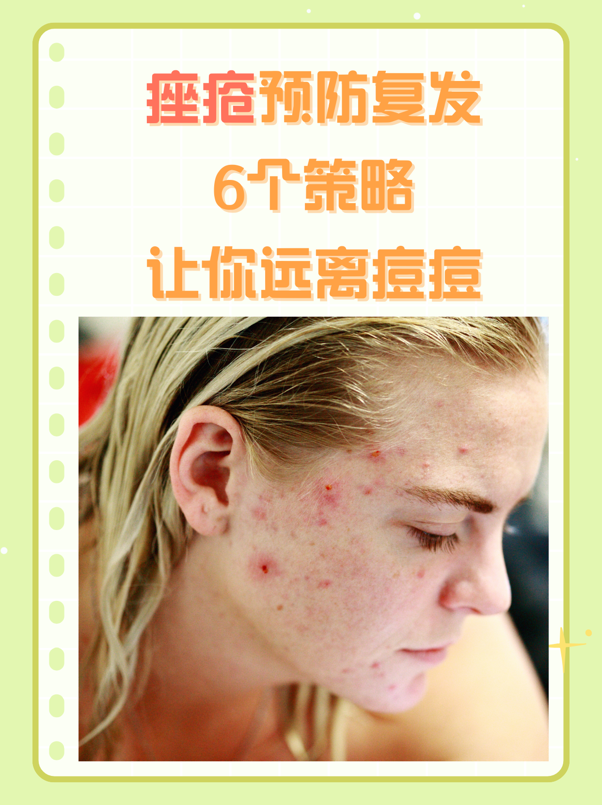 怎么让发炎的痘痘快速消炎