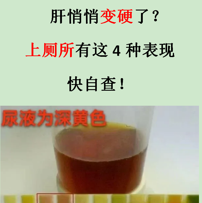 男人小便黄是怎么回事