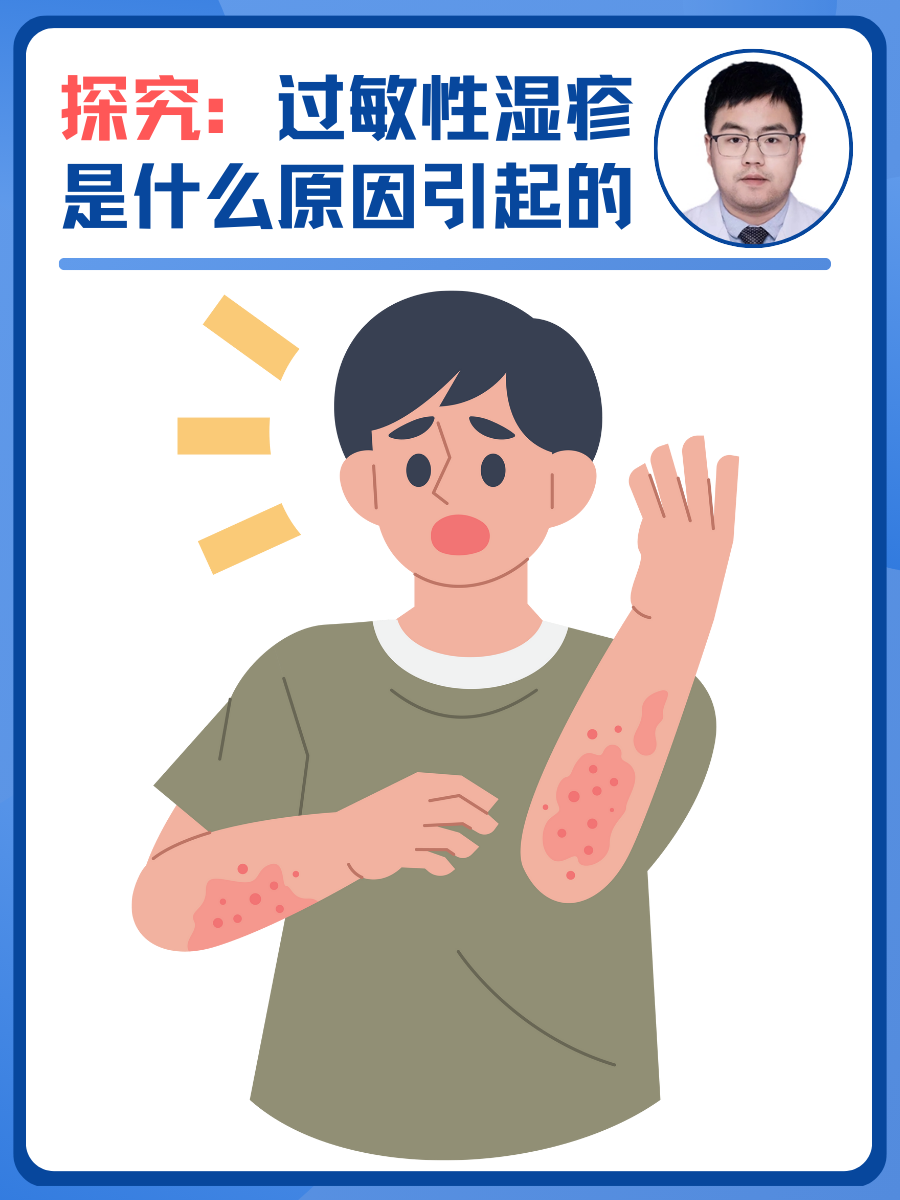引发湿疹的原因都有哪些?