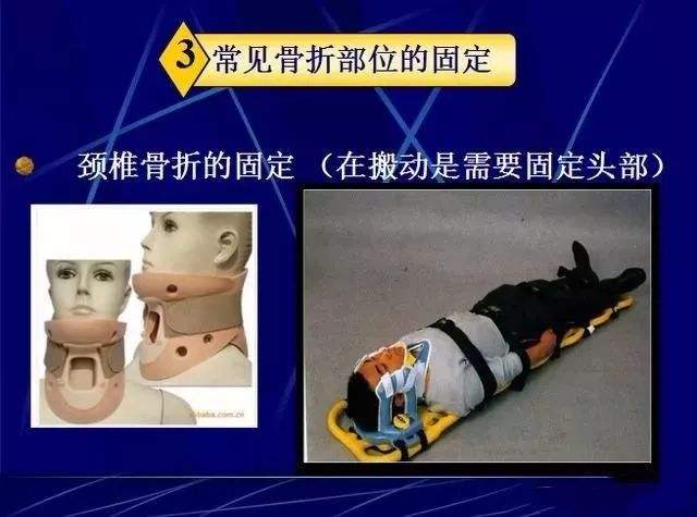 颈椎骨折的护理