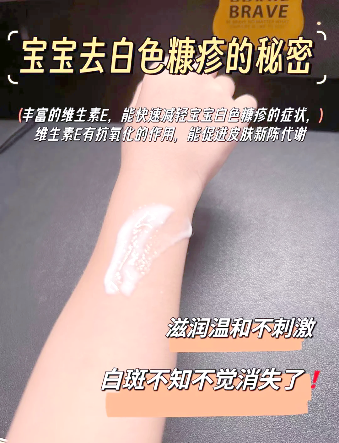 宝宝脸上有白斑怎么办?