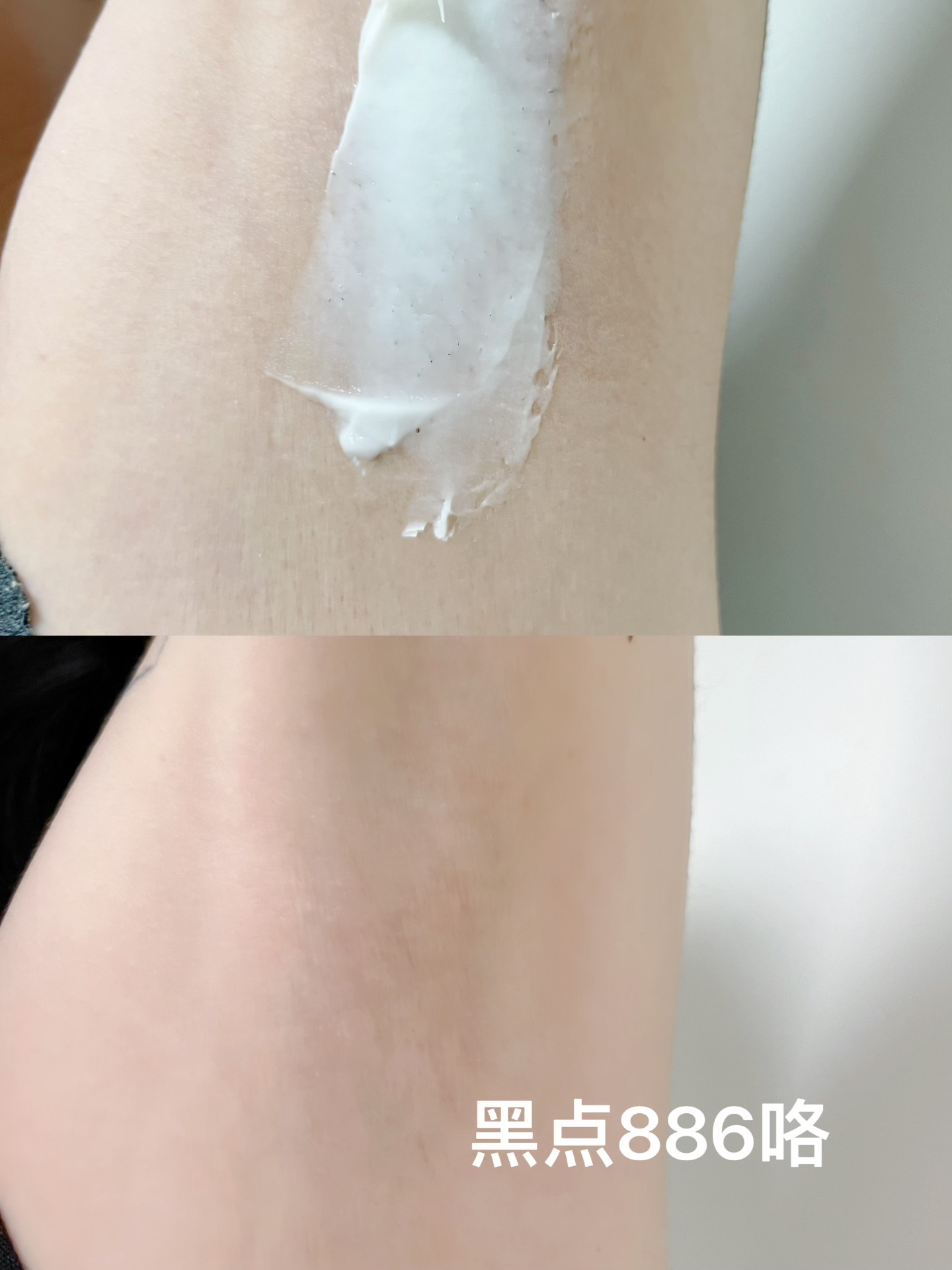 腋毛上有白色物体
