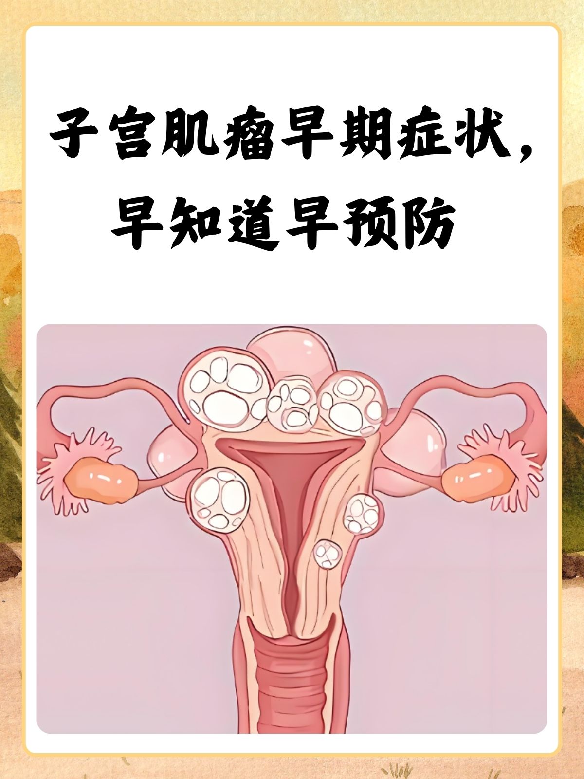 宫颈肌瘤的情况