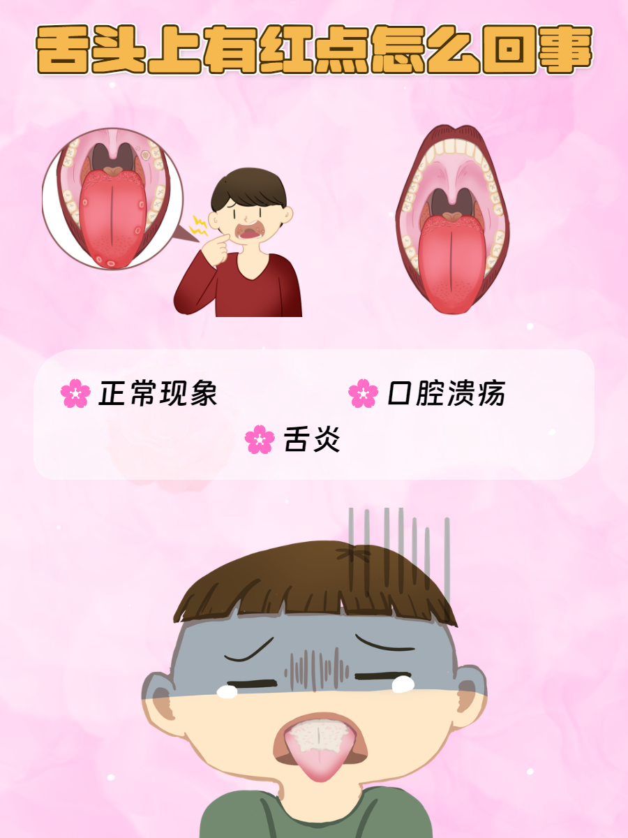 舌尖有小红点怎么回事