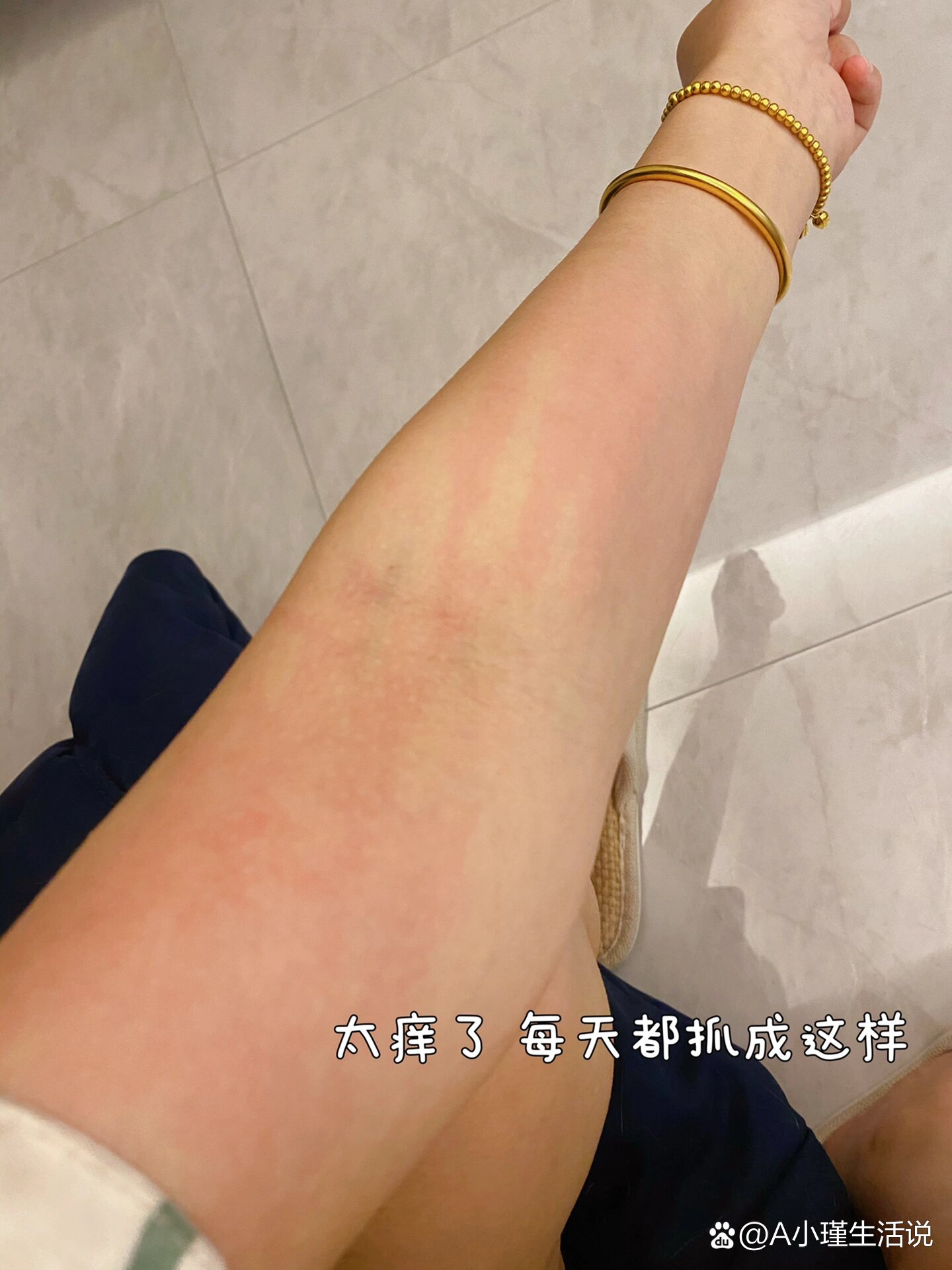 突然全身很痒