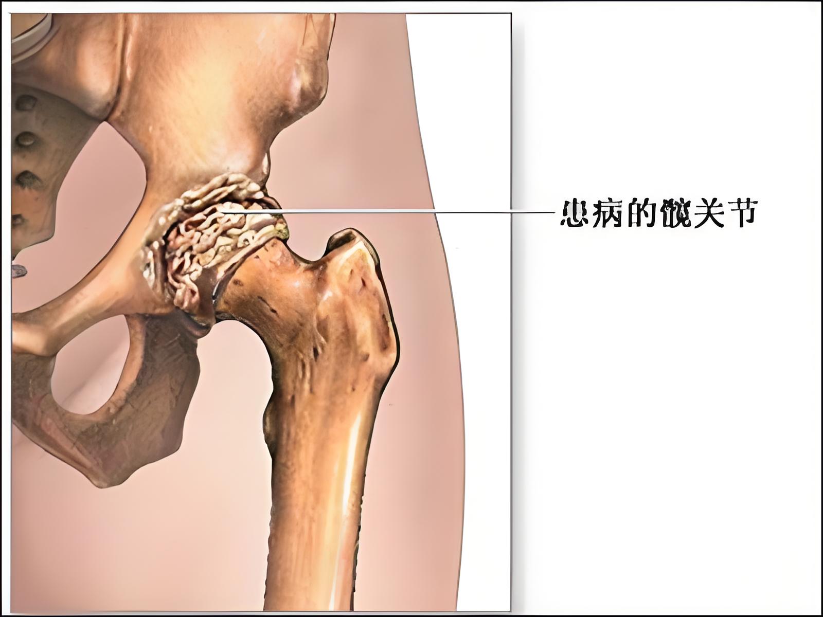 滑膜是哪里