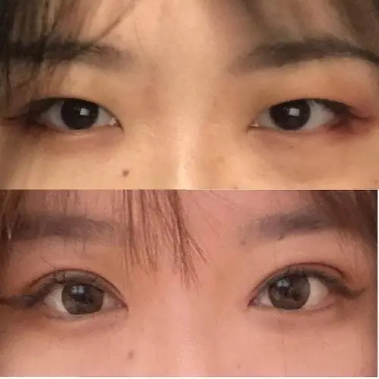 做双眼皮大概多少钱