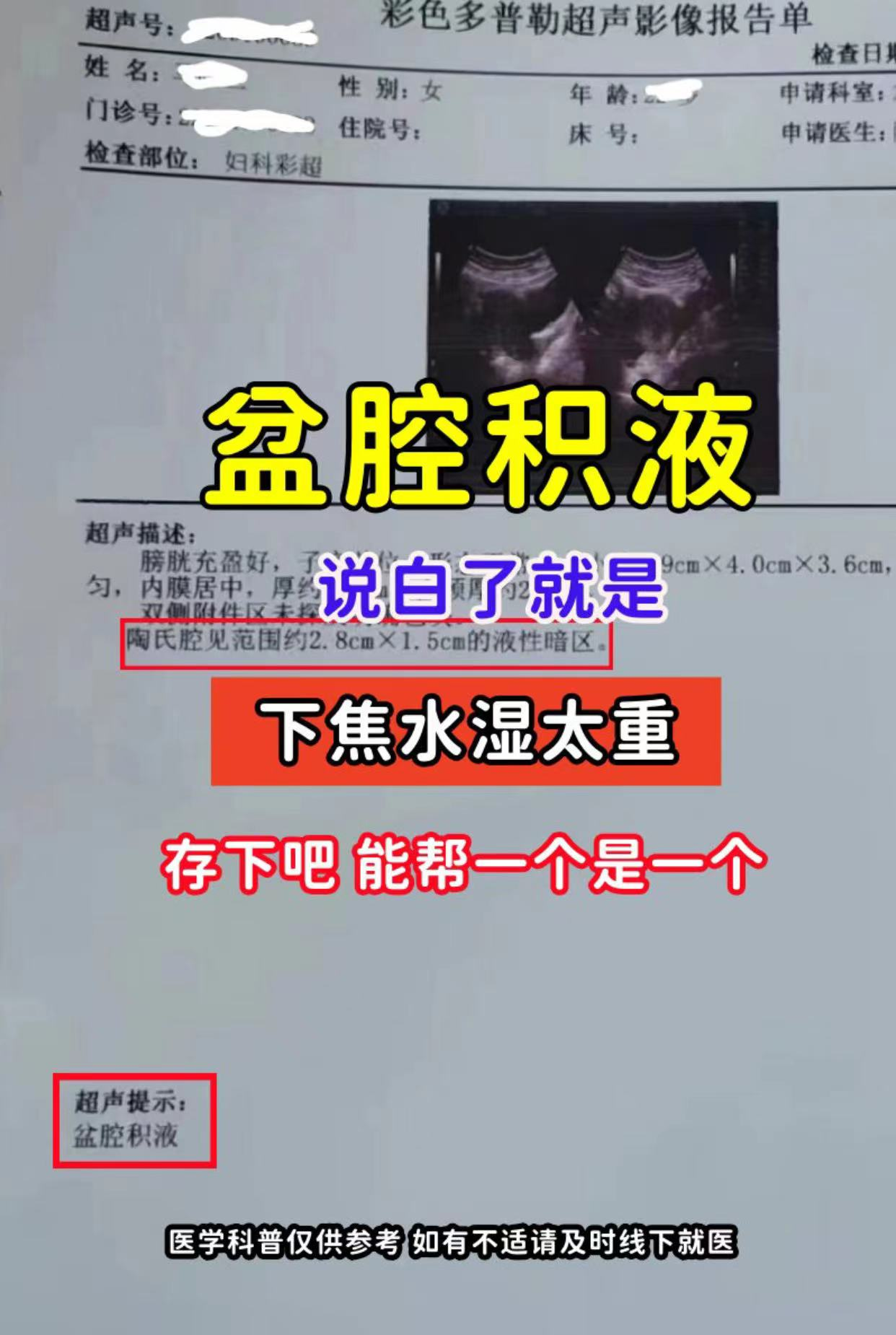 盆腔有积液的原因