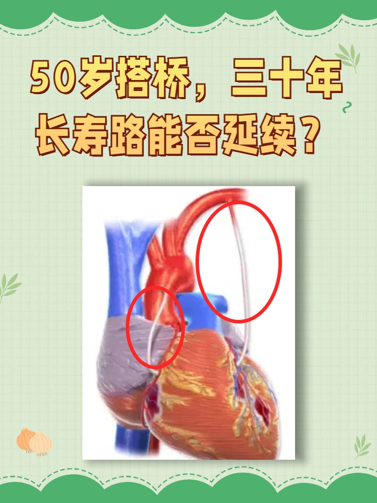 心脏搭桥手术费用多少钱