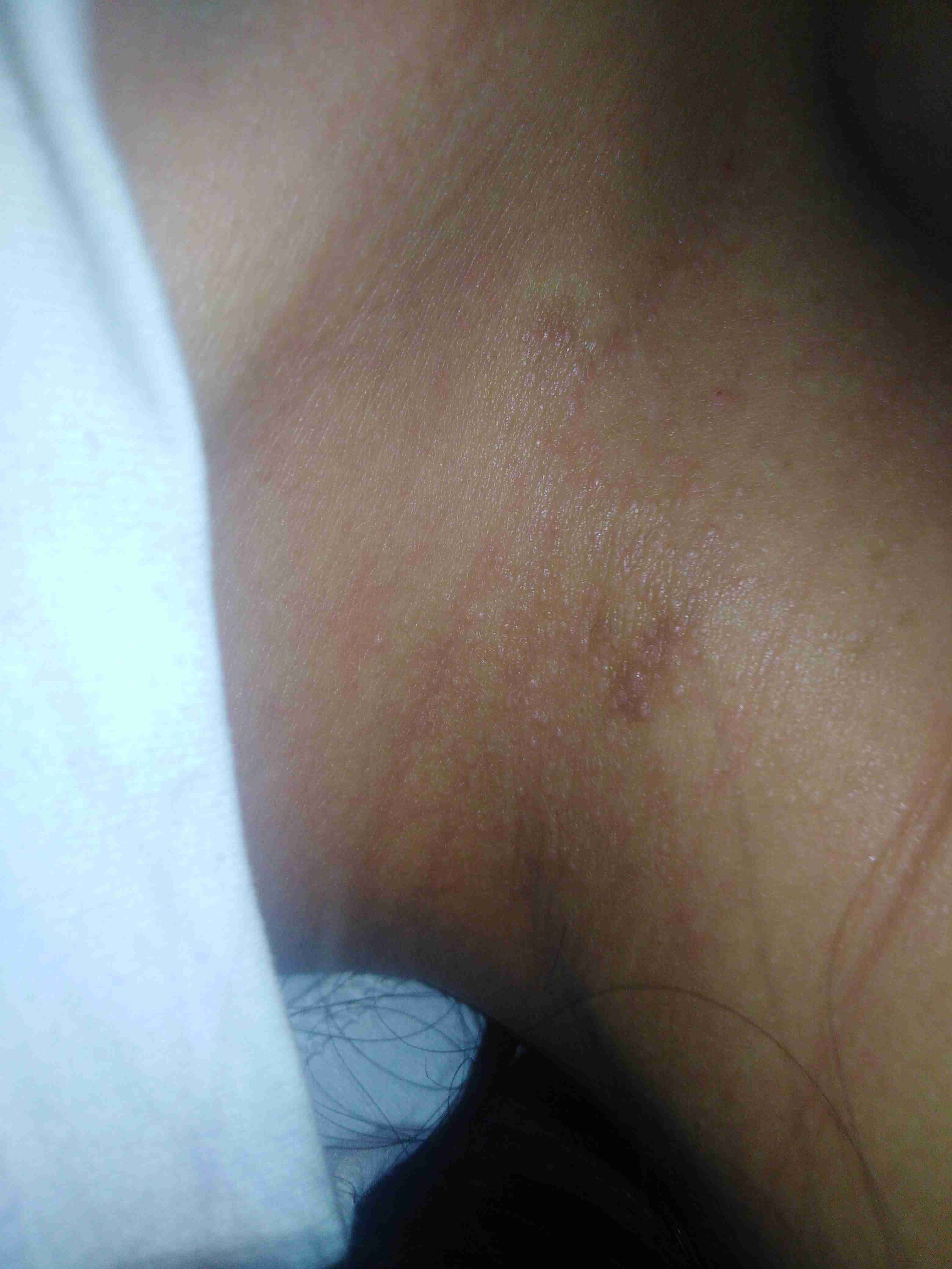 脖子长疙瘩,不疼不痒